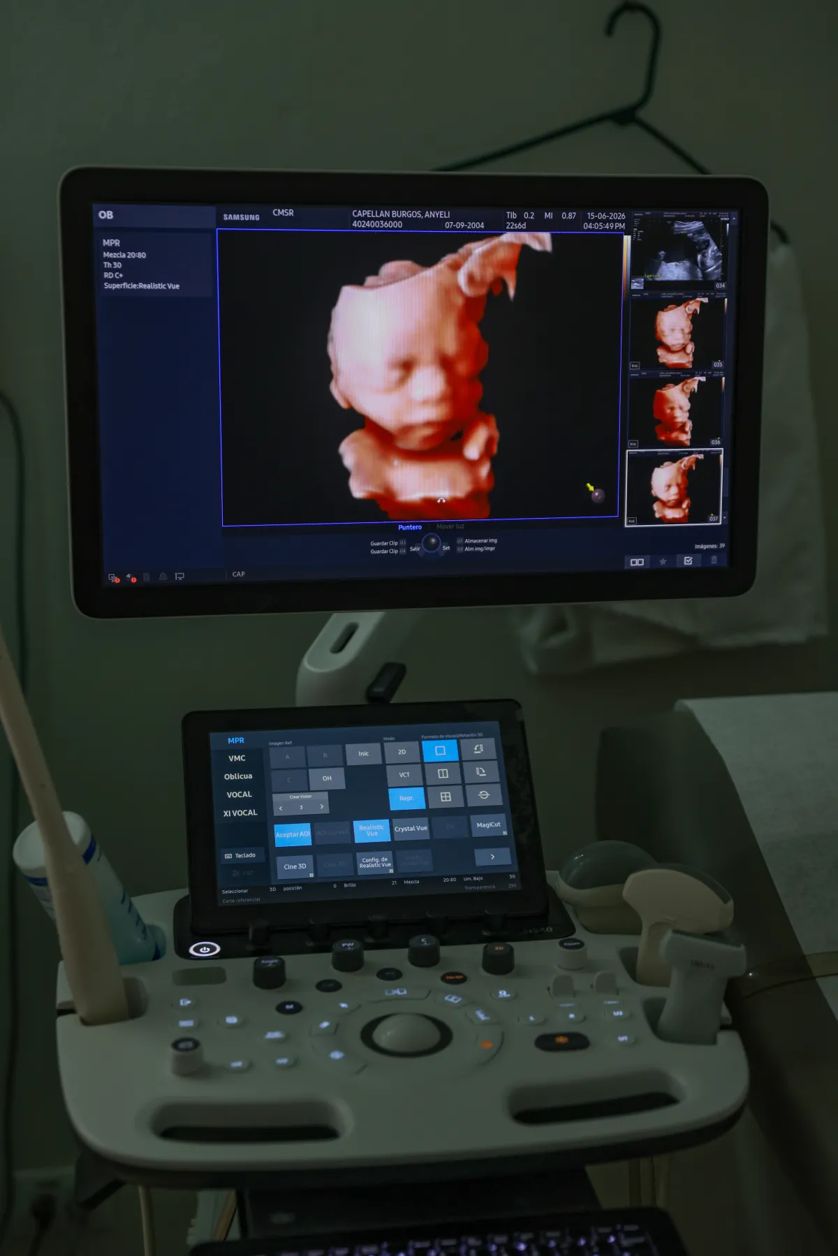 Galería Unidad Materno Fetal